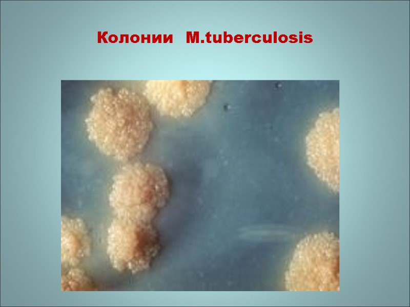 Колонии  M.tuberculosis